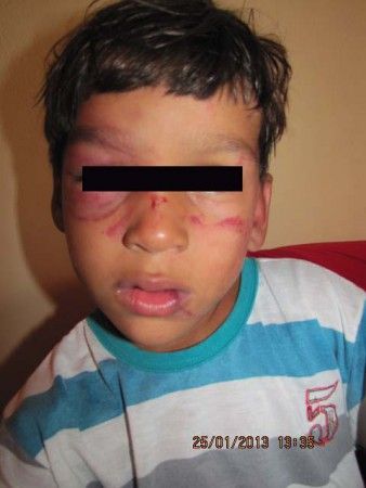 Criança sofreu vários ferimentos no rosto