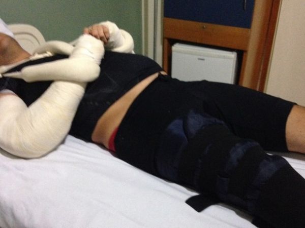 Ciclista quebrou dois os braos e uma perna durante assalto