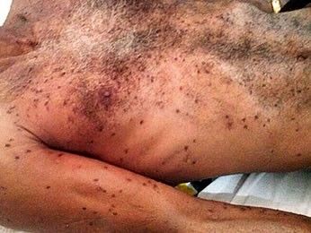 Homem morre em Mato Grosso depois de ser picado por mais de 3 mil abelhas