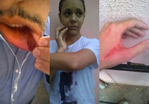 Placa de metal de obra do VLT desprende e machuca pedestre e professor da UFMT