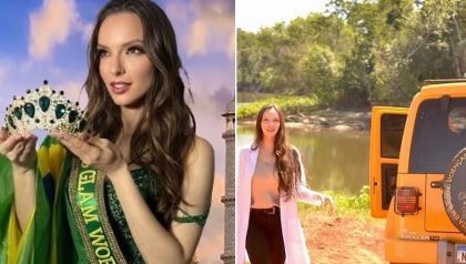 Conhea mdica cuiabana que disputa concurso de beleza na ndia e tem projeto social 'Dermatroller'