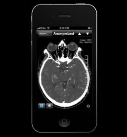 Aplicativo para iPhone promete diagnosticar derrames cerebrais