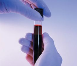 Teste pode apontar cem doenas em amostra de sangue