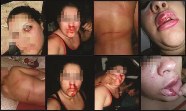 ​Mulher agredida pelo ex-marido denuncia abusos no Facebook e pede ajuda
