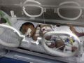 A menina Shayma Sheikh al-Eid  vista em uma incubadora no Hospital Nasser, em Khan Yunis, neste domingo (27), dois dias aps seu nascimento (Foto: Said Khatib/AFP)