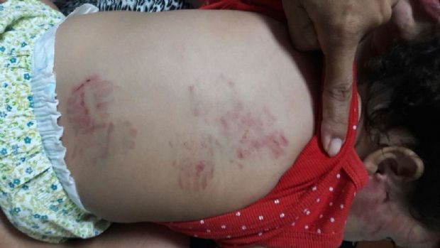 Berrio nega maus-tratos e afirma que beb de 11 meses foi agredida por aluno de dois anos
