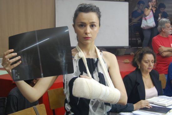 Aluna Bruna exibe a radiografia com a mo quebrada