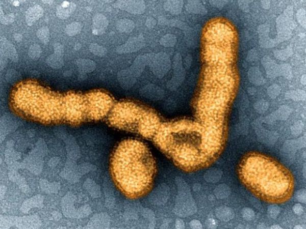 H1N1 em circulao no tem mutao perigosa, revela sequenciamento