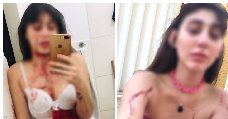 Garota de programa acusa jogador do Cuiab Esporte Clube de agresso em motel