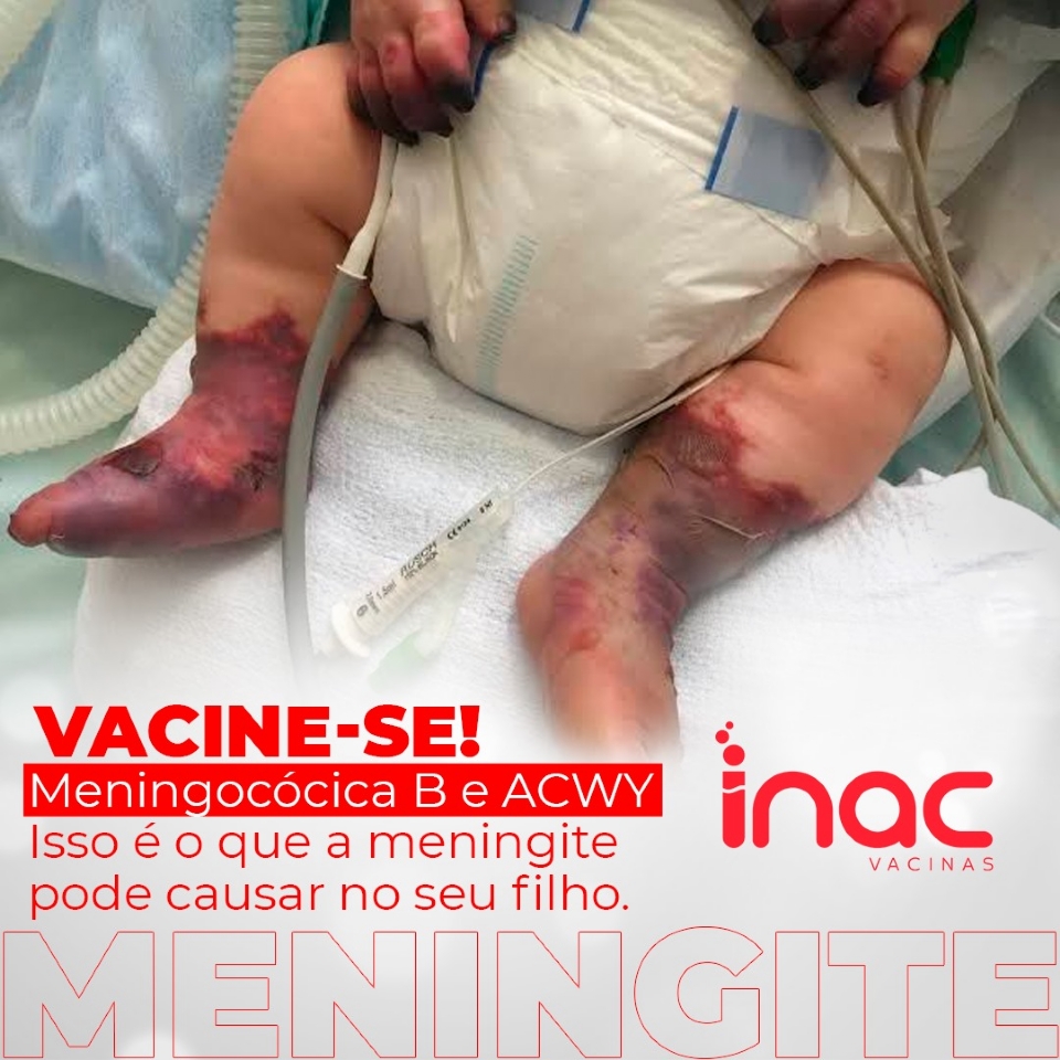 Laboratrio INAC alerta para importncia da vacinao infantil contra meningite