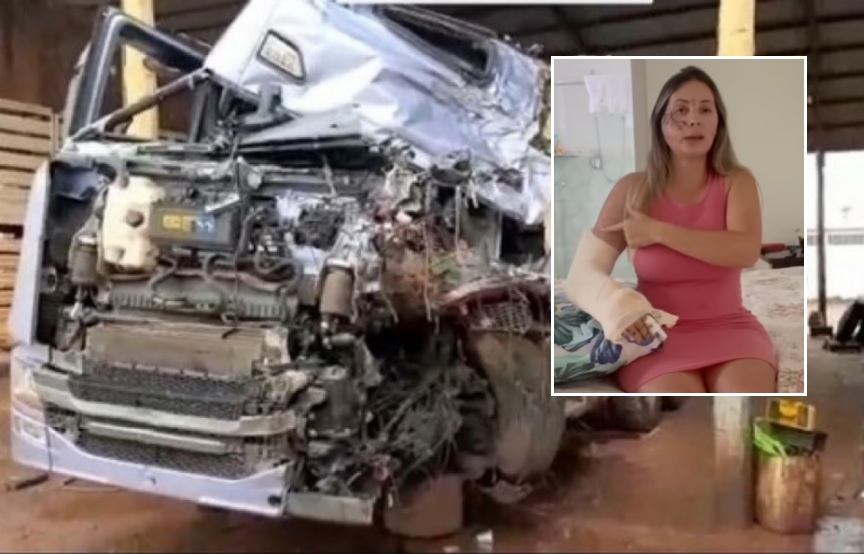Caminhoneira influencer mostra como ficou seu rosto aps acidente em rodovia de MT