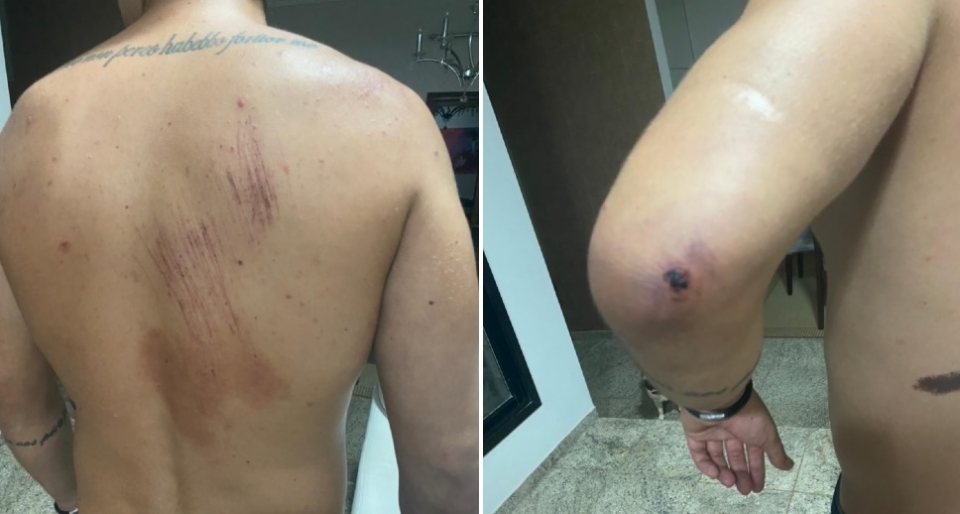 Estudante de medicina bate em carro e  agredido aps provocar militar; fotos e vdeo