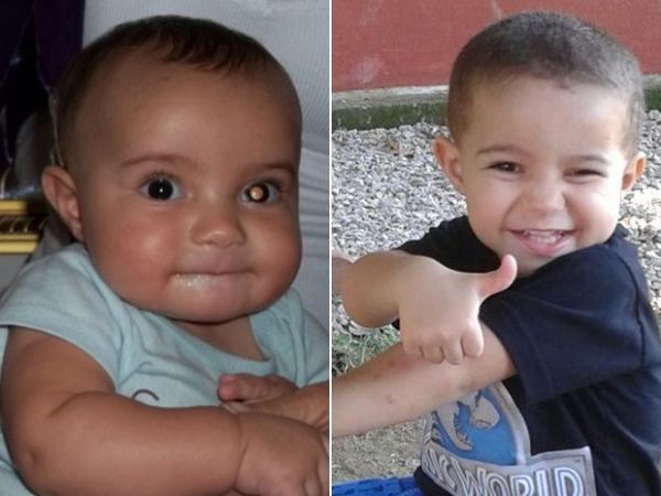 Foto da esquerda revelou mancha no olho que levou a diagnstico de cncer no olho quando Arthur tinha 5 meses; hoje, com 2 anos, o garoto est em fase de controle da doena