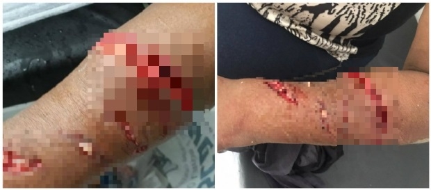 Jacar ataca mulher que limpava peixe s margens de crrego na Baixada Cuiabana