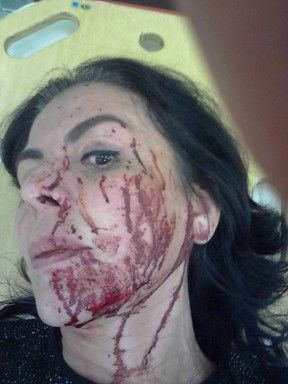 Castrinho sofre tentativa de assalto e mulher  baleada de raspo