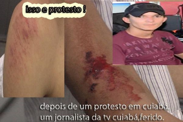 Cinegrafista  agredido durante manifestao por dez vndalos