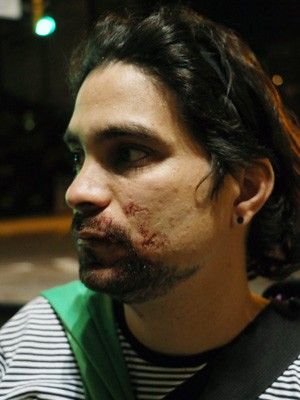 'Nunca mais volto', diz colombiano ao relatar ter sido agredido no RS