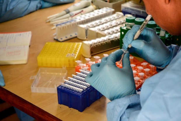Laboratrio de Cuiab recebe cerca de 100 kits para diagnstico de coronavrus