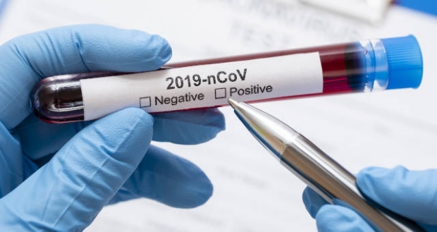 Cidade de MT confirma 5 caso de coronavirus; outros 70 investigados
