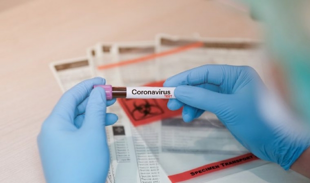 Cuiab tem taxa de incidncia de coronavrus maior que a mdia nacional, mostra Informe Epidemiolgico