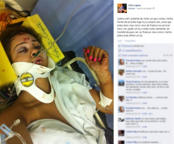 Integrante do reality show 'Casa Bonita' sofre acidente de moto
