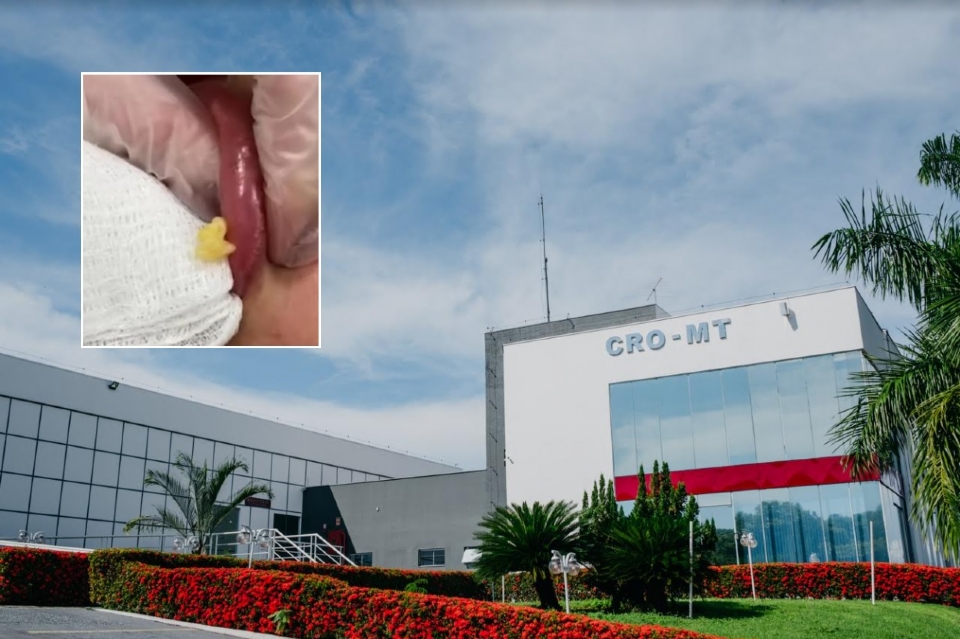 CRO rebate mdica que criticou autorizao de dentistas para realizao de harmonizao orofacial