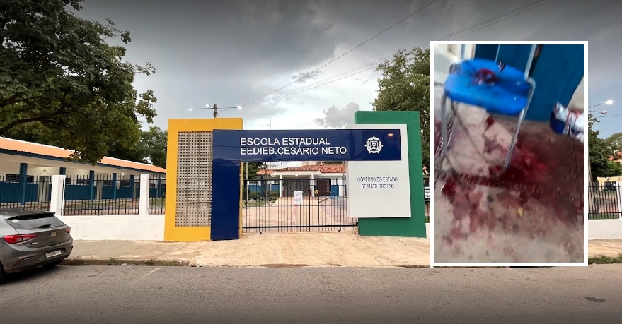Estudante de 19 anos  esfaqueada no pescoo por aluna de 22 em Cuiab