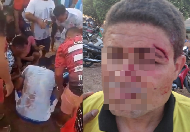 rbitro  atingido por garrafa no rosto durante torneio de futebol amador em Cuiab