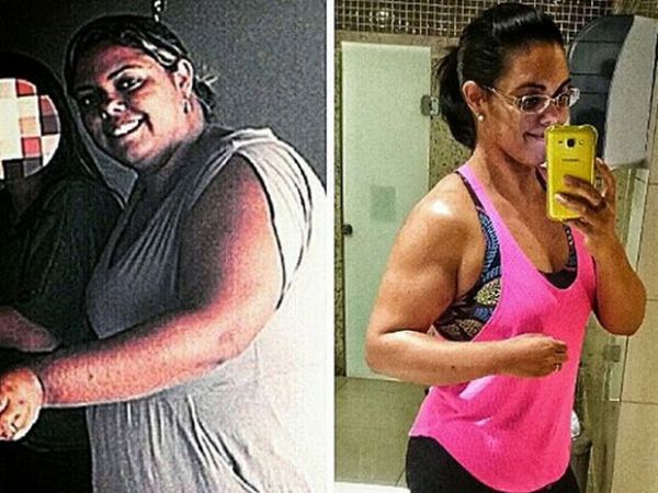 Mulher perde 41 kg com exerccios e dieta ao ter cirurgia negada por plano