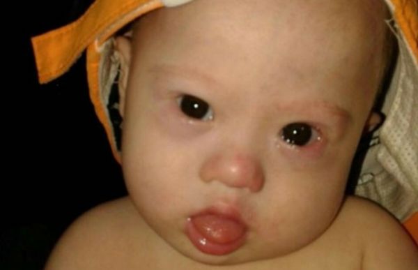 Casal australiano abandona beb com Sndrome de Down na Tailndia