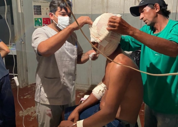 Indgena ferido na cabea durante ataque de ona pintada  transferido para Cuiab; Veja fotos 