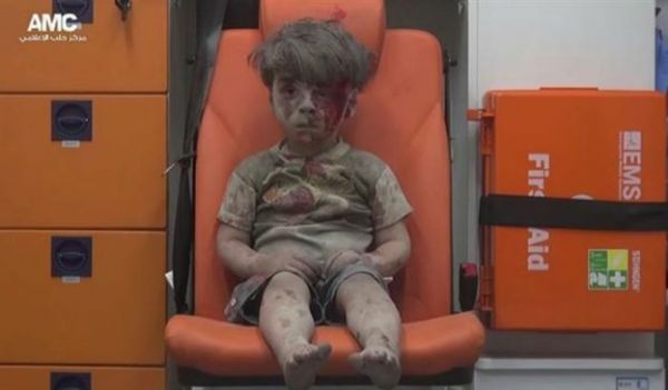 Foto de menino sírio é lembrete dos horrores inimagináveis da guerra, diz UNICEF