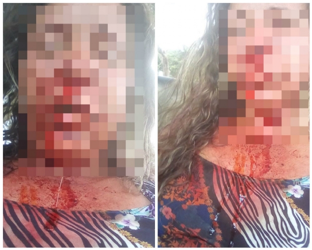 Mulher  espancada pelo marido na frente da filha de trs anos: 