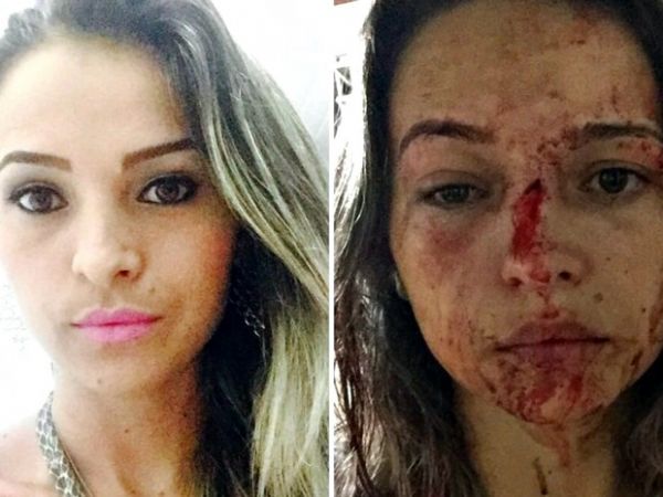 'Implorei que parasse', diz jovem agredida por lutador de MMA