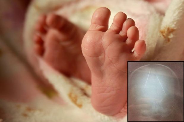 Pais e outras trs pessoas so indiciadas por torturar beb de 3 meses com agulhas