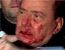 Primeiro-ministro da Itlia quebra o nariz e dois dentes ao ser agredido