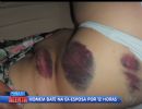 Mulher  agredida pelo ex-marido durante 12 horas