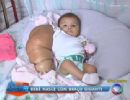 Famlia busca tratamento no Rio para beb com problemas