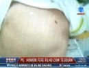 Homem fura o filho de 26 dias com tesoura em Pernambuco